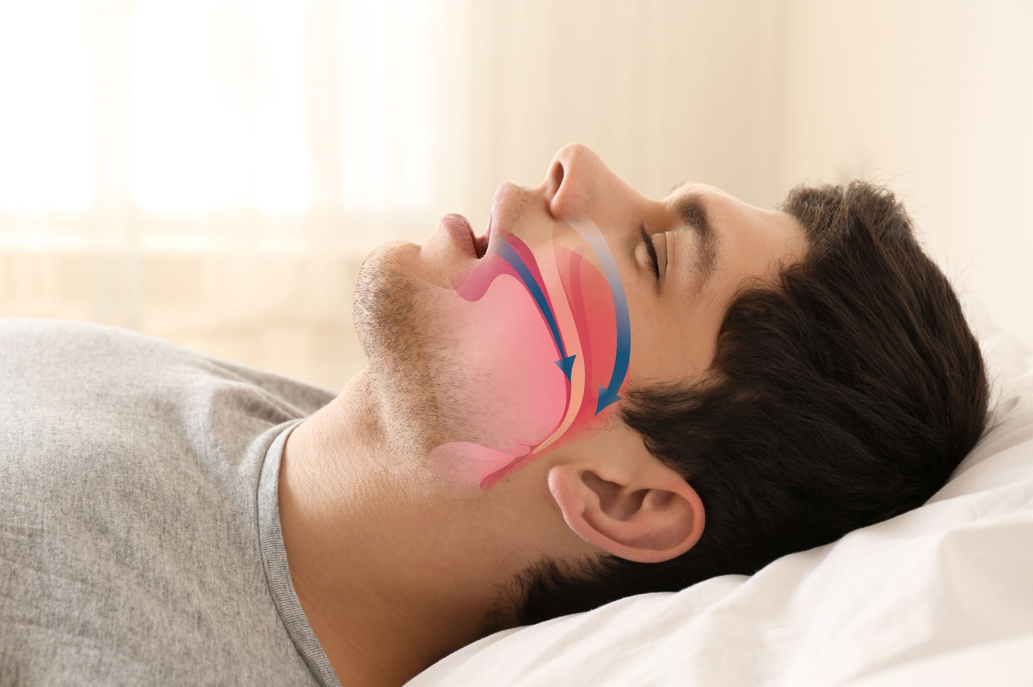 stop-snoring-advanced-ent-allergy